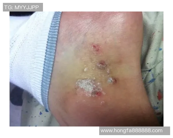 足球明星如何科学保养脚踝保持最佳状态的图片分享与技巧解析